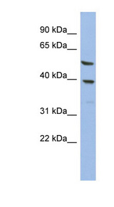 OLAH antibody LS-C111865 Western blot of HT1080 cell lysate.