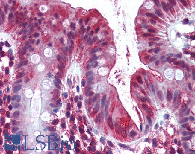 Anti-OLFM4 antibody IHC of human colon. Immunohistochemistry of formalin-fixed, paraffin-embedded tissue after heat-induced antigen retrieval. Antibody LS-B2055 concentration 5 ug/ml.