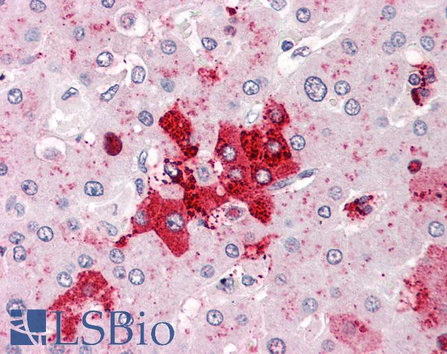 Anti-OLFM4 antibody LS-A8454 IHC of human liver. Immunohistochemistry of formalin-fixed, paraffin-embedded tissue after heat-induced antigen retrieval.