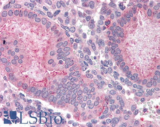 Anti-OLFM4 antibody LS-A8455 IHC of human uterus. Immunohistochemistry of formalin-fixed, paraffin-embedded tissue after heat-induced antigen retrieval.