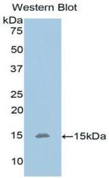 Western blot of recombinant OLFM4 / Olfactomedin 4.