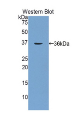 Western blot of recombinant OLFM4 / Olfactomedin 4.