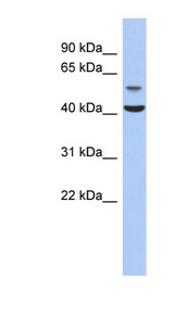 OLFML1 antibody LS-C111728 Western blot of Fetal Muscle lysate.