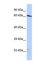 OLFML2A antibody LS-C102540 Western blot of HepG2 cell lysate.
