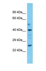 Western blot of OLFML3 Antibody with Uterus Tumor lysate.