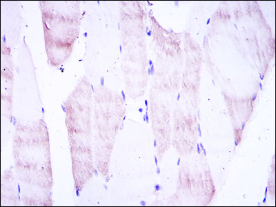 IHC of paraffin-embedded muscle tissues using OLIG2 mouse monoclonal antibody with DAB staining.