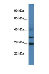 OLIG3 antibody LS-C145317 Western blot of Rat Muscle lysate. Antibody concentration 1 ug/ml.