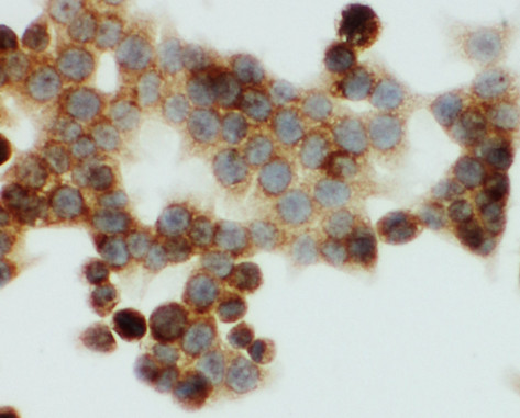 ONECUT1 / HNF6 antibody. ICC: HCT116 Cell.