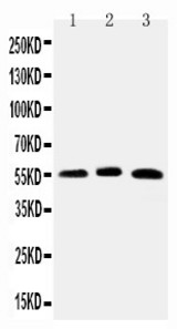 WB of ONECUT1 / HNF6 antibody. Lane 1: Rat Liver Tissue Lysate. Lane 2: Mouse Liver Tissue Lysate. Lane 3: HELA Cell Lysate.
