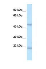 ONECUT1 antibody LS-C145424 Western blot of Mouse Liver lysate. Antibody concentration 1 ug/ml.