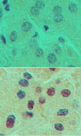 IHC of HNF6 in formalin-fixed, paraffin-embedded human liver tissue using an isotype control (top) and LS-C148720 (bottom) at 5 ug/ml.
