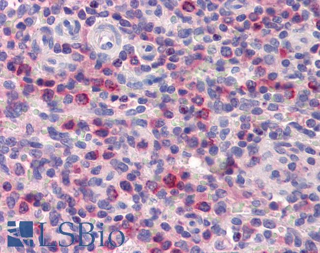 Anti-ONECUT1 antibody IHC of human spleen. Immunohistochemistry of formalin-fixed, paraffin-embedded tissue after heat-induced antigen retrieval. Antibody LS-B3525 concentration 5 ug/ml.