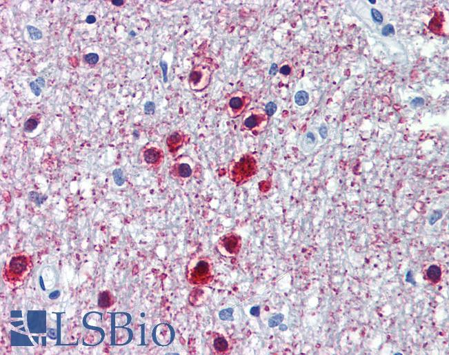 Anti-ONECUT1 antibody IHC of human brain, cerebellum. Immunohistochemistry of formalin-fixed, paraffin-embedded tissue after heat-induced antigen retrieval. Antibody LS-B3525 concentration 5 ug/ml.