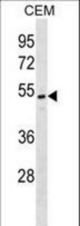 ONECUT2 Antibody western blot of CEM cell line lysates (35 ug/lane). The ONECUT2 antibody detected the ONECUT2 protein (arrow).