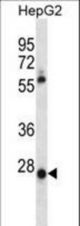 MEOX1 Antibody western blot of HepG2 cell line lysates (35 ug/lane). The MEOX1 antibody detected the MEOX1 protein (arrow).