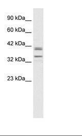 Jurkat Cell Lysate
