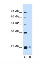 Lane A: Marker. Lane B: HepG2 cell lysate. Antibody concentration: 0.5 ug/ml. Gel concentration: 12%.