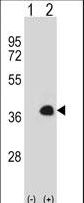 Western blot of MEOX1 (arrow) using rabbit polyclonal MEOX1 Antibody. 293 cell lysates (2 ug/lane) either nontransfected (Lane 1) or transiently transfected (Lane 2) with the MEOX1 gene.
