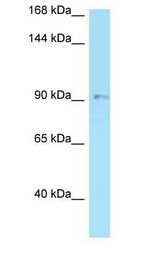 OPA1 antibody Western Blot of HT1080.