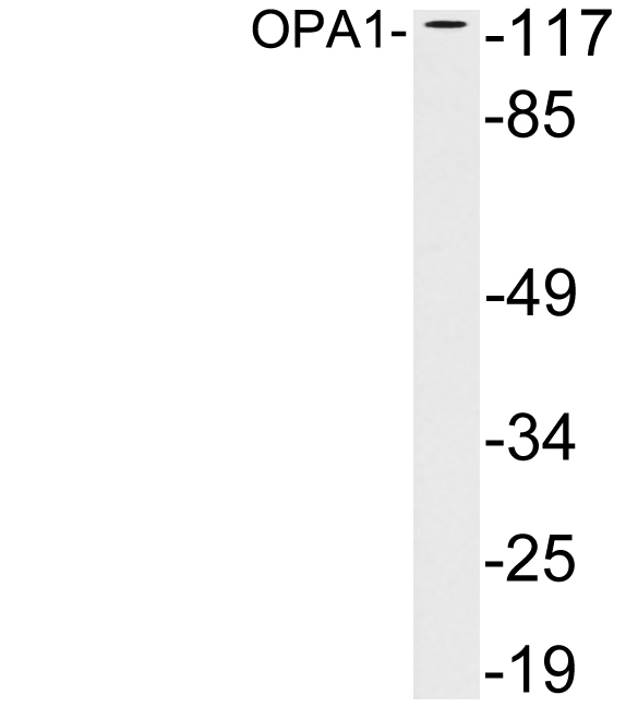 Western blot of extracts from brain tissue, using OPA1 antibody.