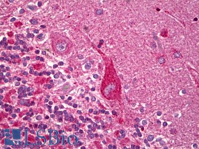 Anti-OPA1 antibody IHC of human brain, cerebellum, Purkinje cells. Immunohistochemistry of formalin-fixed, paraffin-embedded tissue after heat-induced antigen retrieval. Antibody LS-B6560 dilution 1:100.