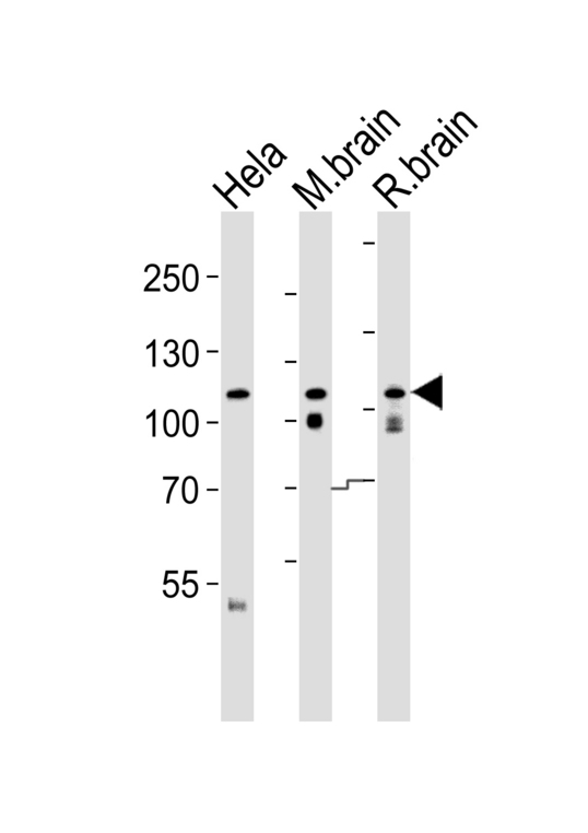 Western blot of lysates from HeLa cell line , mouse brain and rat brain tissue lysate (from left to right) with OPA1 (form S1) Antibody. Antibody was diluted at 1:1000 at each lane. A goat anti-rabbit IgG H&L (HRP) at 1:5000 dilution was used as the secondary antibody. Lysates at 35 ug per lane.