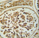 Formalin-fixed and paraffin-embedded human testis tissue reacted with OPLAH Antibody , which was peroxidase-conjugated to the secondary antibody, followed by DAB staining. This data demonstrates the use of this antibody for immunohistochemistry; clinical relevance has not been evaluated.