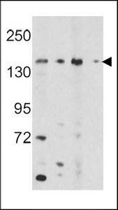 Western blot of OPLAH Antibody in K562, HepG2 cell line lysates and mouse bladder, liver tissue lysates (35 ug/lane). OPLAH (arrow) was detected using the purified antibody.