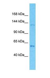 Western blot of OPLAH Antibody with human MCF7 Whole Cell lysate.