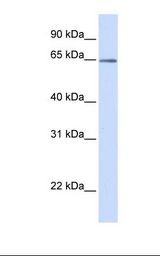 MCF7 cell lysate. Antibody concentration: 1.0 ug/ml. Gel concentration: 12%.