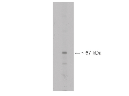WB: Anti-optineurin on mouse retina lysate.