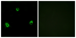 Immunofluorescence of MCF7 cells, using OR10A4 Antibody. The picture on the right is treated with the synthesized peptide.