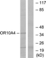 Western blot of extracts from COLO cells, using OR10A4 Antibody. The lane on the right is treated with the synthesized peptide.