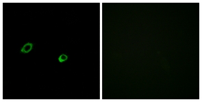 Immunofluorescence of MCF7 cells, using OR10AG1 Antibody. The sample on the right was incubated with synthetic peptide.