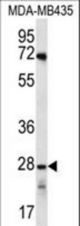 OR10AG1 Antibody western blot of MDA-MB435 cell line lysates (35 ug/lane). The OR10AG1 antibody detected the OR10AG1 protein (arrow).