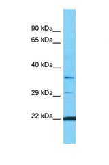 Western blot of Human MCF7. OR10G9 antibody dilution 1.0 ug/ml.
