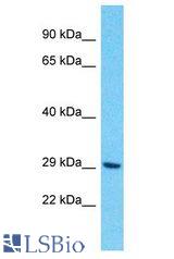 OR10H4 antibody Western Blot of HCT15. Antibody dilution: 1 ug/ml.