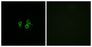 Immunofluorescence of A549 cells, using OR10H4 Antibody. The picture on the right is treated with the synthesized peptide.