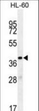 OR10J5 Antibody western blot of HL-60 cell line lysates (35 ug/lane). The OR10J5 antibody detected the OR10J5 protein (arrow).
