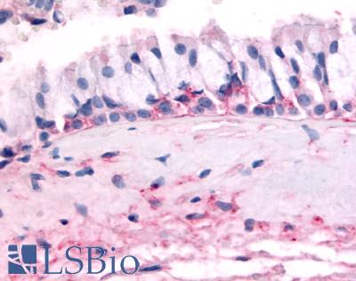 Anti-OR10J5 antibody LS-A3159 IHC of human nasal mucosa, respiratory epithelium. Immunohistochemistry of formalin-fixed, paraffin-embedded tissue after heat-induced antigen retrieval.
