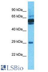 OR10J5 antibody Western Blot of ACHN. Antibody dilution: 1 ug/ml.