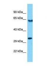 Western blot of Human HepG2. OR10R2 antibody dilution 1.0 ug/ml.