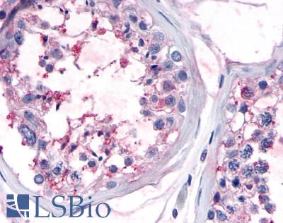 Anti-OR10R2 antibody LS-A4541 IHC of human testis, seminiferous epithelium. Immunohistochemistry of formalin-fixed, paraffin-embedded tissue after heat-induced antigen retrieval.