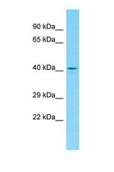 Western blot of Human Jurkat. OR10S1 antibody dilution 1.0 ug/ml.