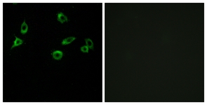 Immunofluorescence of MCF7 cells, using OR10S1 Antibody. The picture on the right is treated with the synthesized peptide.