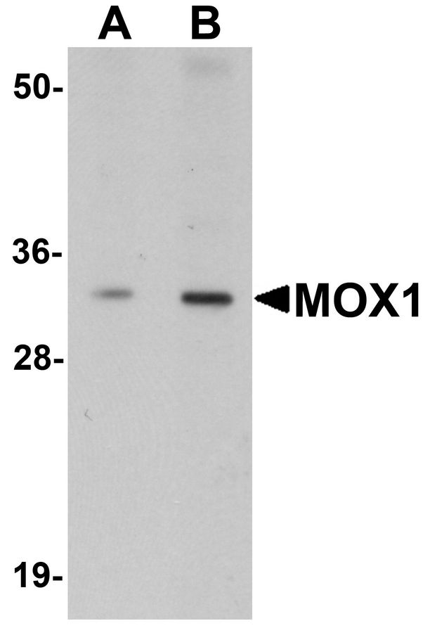 Western blot analysis of MOX1 in human liver tissue lysate with MOX1 antibody at (A) 1 and (B) 2 ug/ml.