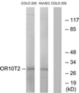 Western blot of extracts from HUVEC/COLO cells, using OR10T2 Antibody. The lane on the right is treated with the synthesized peptide.