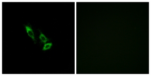 Immunofluorescence of A549 cells, using OR10V1 Antibody. The picture on the right is treated with the synthesized peptide.