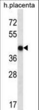OR10V1 Antibody western blot of human placenta tissue lysates (35 ug/lane). The OR10V1 antibody detected the OR10V1 protein (arrow).