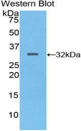 Western blot of recombinant MEP1A.